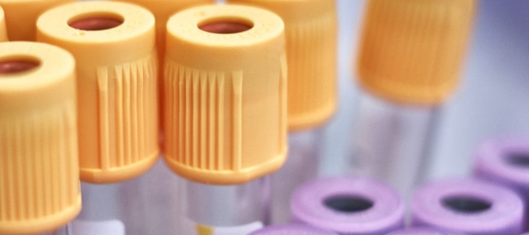 Blood Tests For Menopause Viv Health