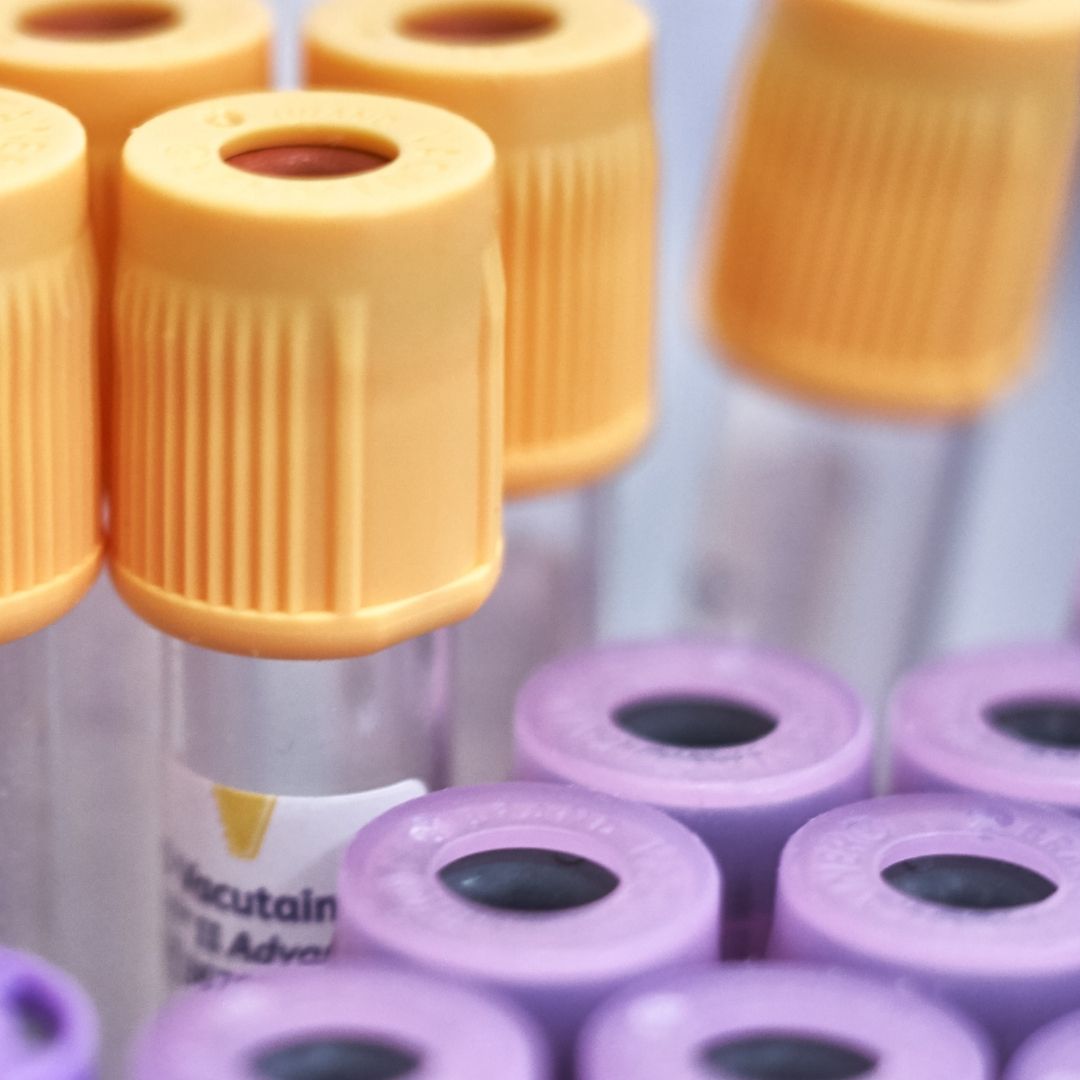 Blood Tests For Menopause Viv Health